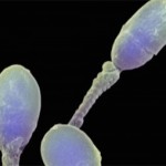 Sperm.Figure. from turek blog