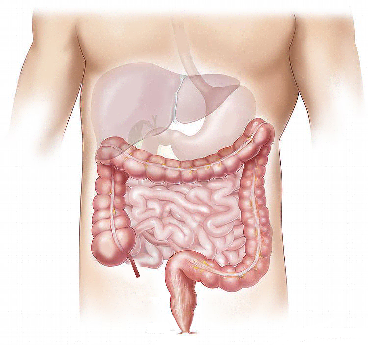 recognizing colorectal cancer